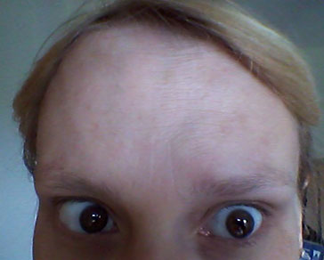Trying to raise eyebrows after Bocouture treatment